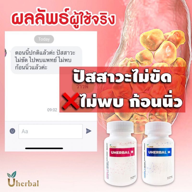 สมุนไพรรักษานิ่ว