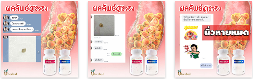 เป็นนิ่วในกระเพาะปัสสาวะห้ามกินอะไรบ้าง?
