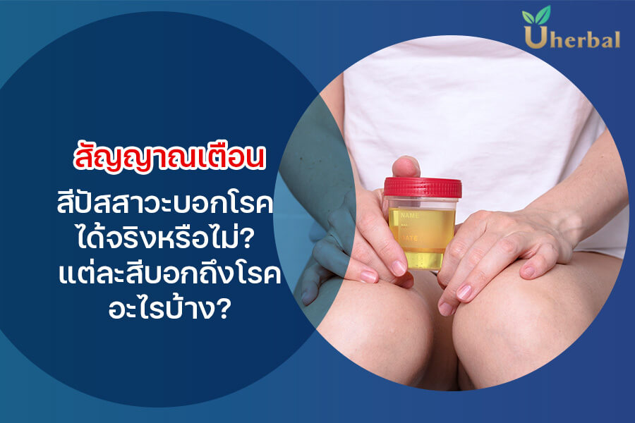 สัญญาณเตือน สีปัสสาวะบอกโรค ได้จริงหรือไม่ ? แต่ละสีบอกถึงโรคอะไรบ้าง ?